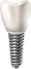 Graphic of a dental implant